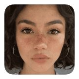 Soft Freckles
