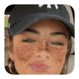 Cp Freckles