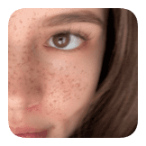 NATURAL FRECKLES