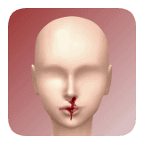Nosebleed