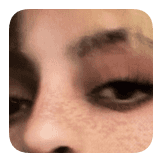 Freckles