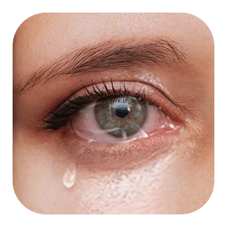Watery Eyes